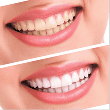 Load image into Gallery viewer, [3-Pack] White Bright - Now Teeth Whitening Changes Forever
