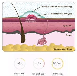 Gel Scar Therapy Patch